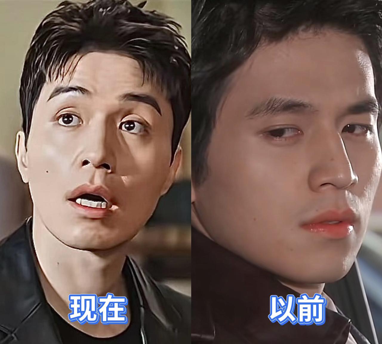 李栋旭现在照镜子的时候会想哭吧原本被人称之为韩国初代男神的一张脸，现在突