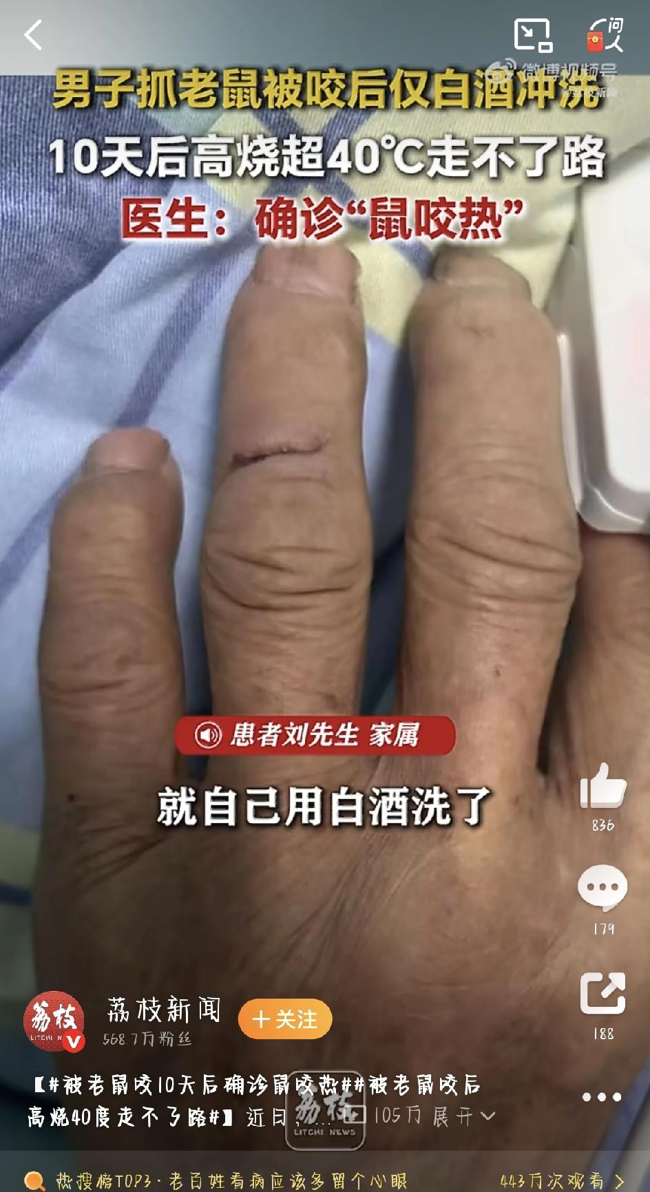 深圳最近出了件特别吓人的真事儿，看完我反正是再也不敢随便抓老鼠了！保安刘大哥在