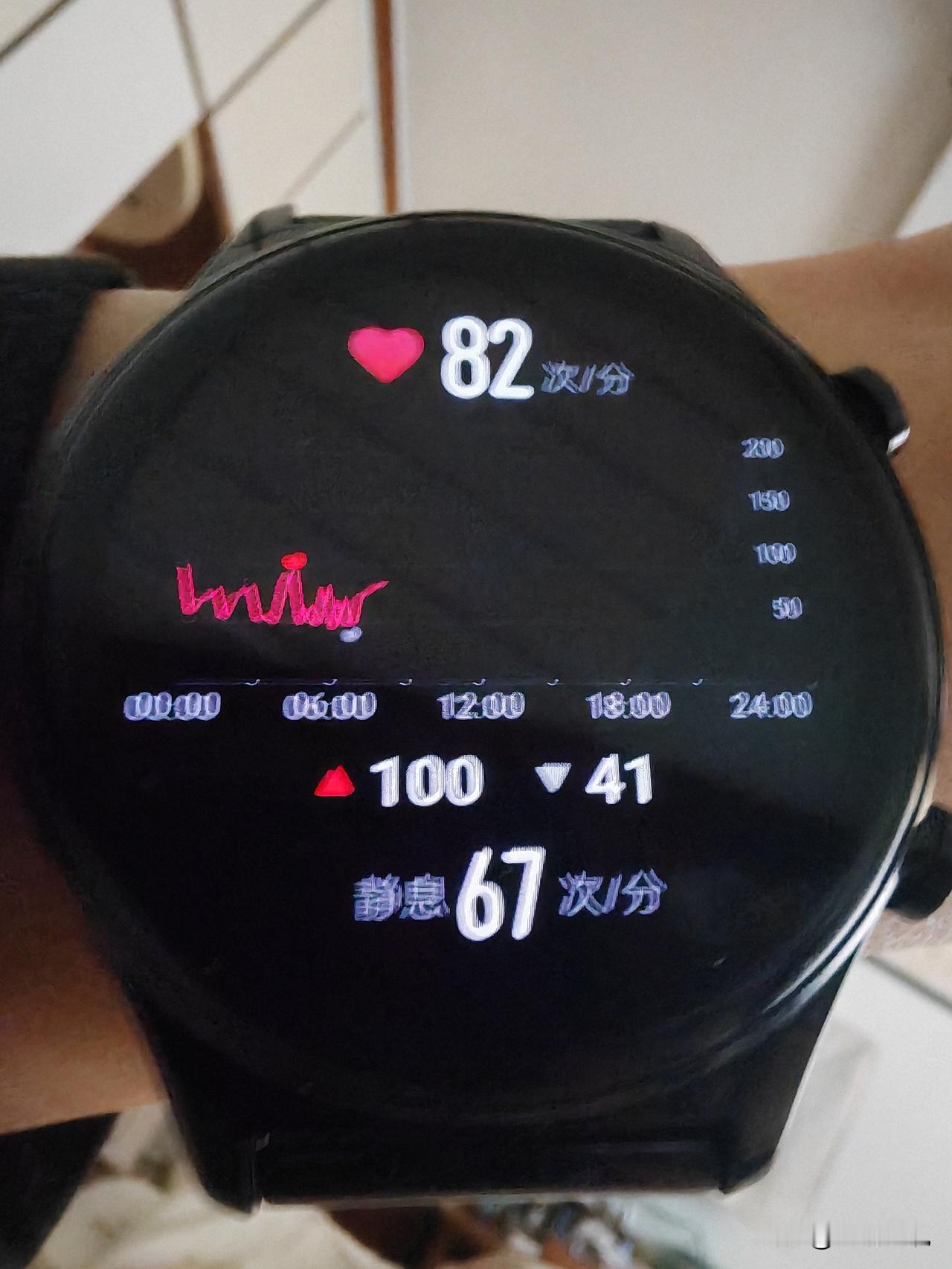 有懂行的朋友吗？这个数据是不是有问题？心率高的时候100，低的时候41，静息67