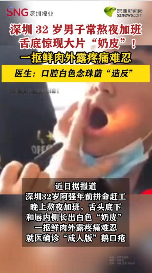 “太恐怖了！”近日，广东深圳，一名32岁男子为赶项目连续半个月熬夜加班，拼命赶工