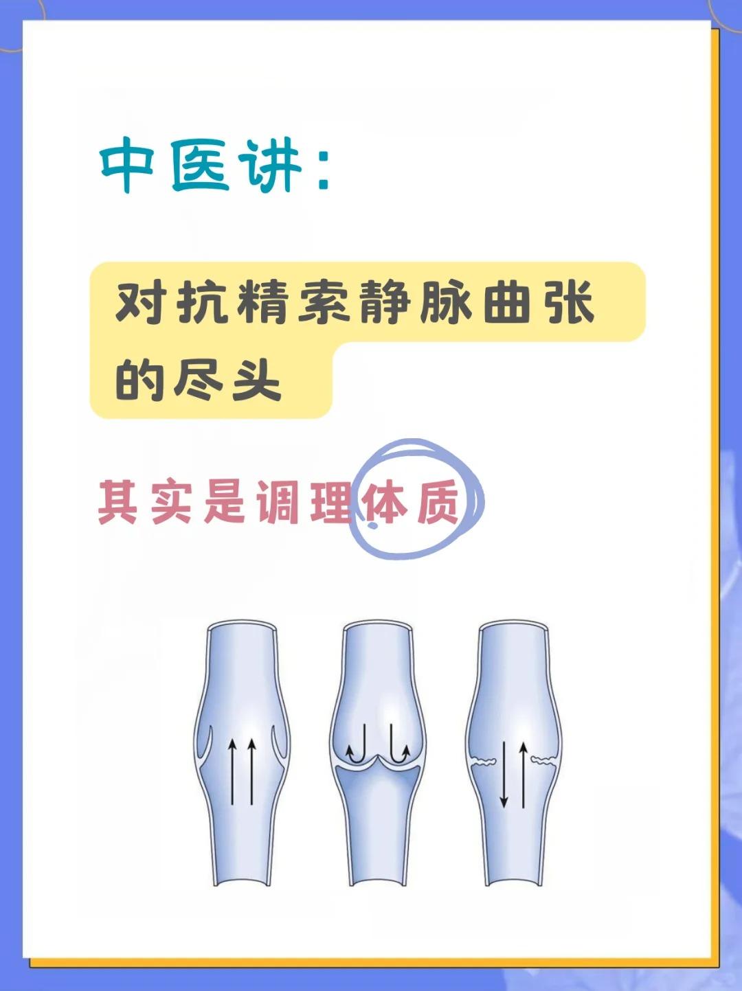 【中医：精索静脉曲张的终极答案~就藏在体质里！】男性面对精索静脉曲