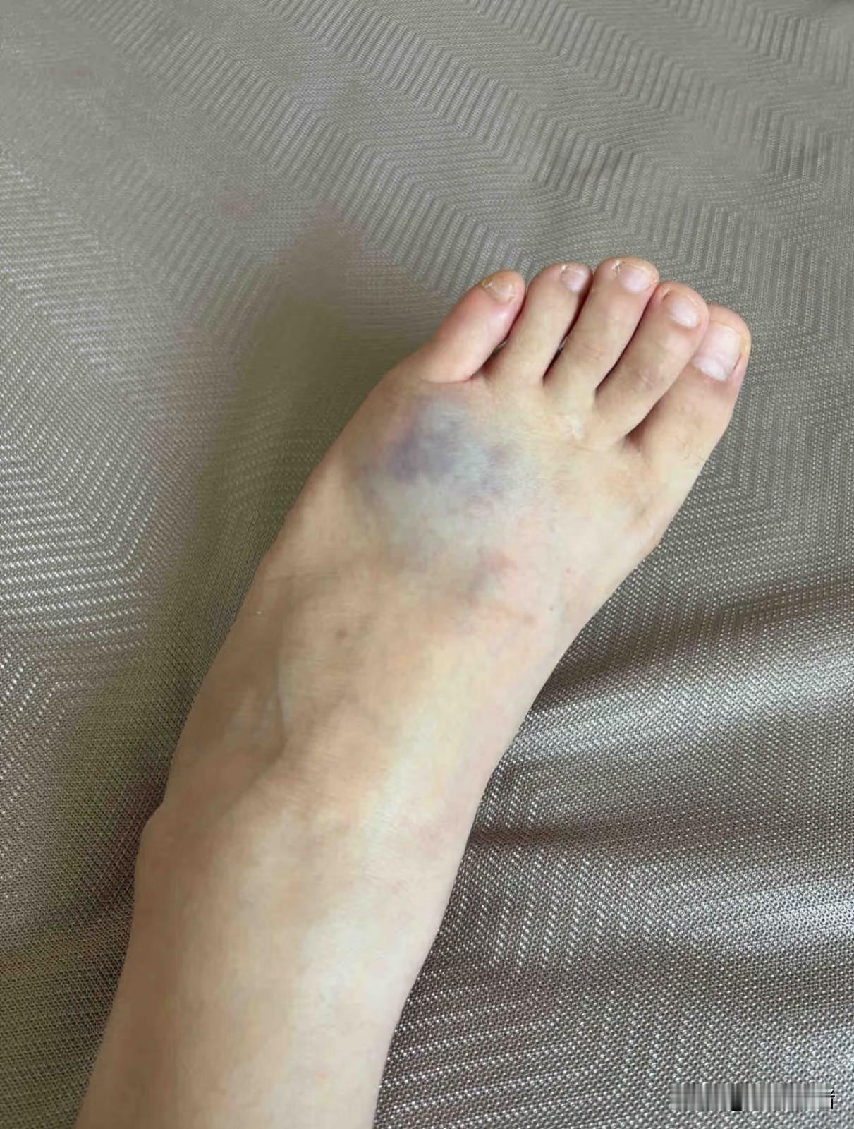 婆婆对门老两口吵架，我婆婆好心劝架，结果劝着劝着两人动手了，女的一腿重重踩在婆婆