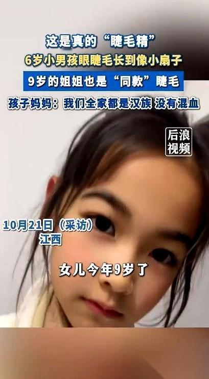 睫毛长到要用梳子梳，我第一次听说。江西上饶一个6岁的小男孩，睫毛快2厘米了。真