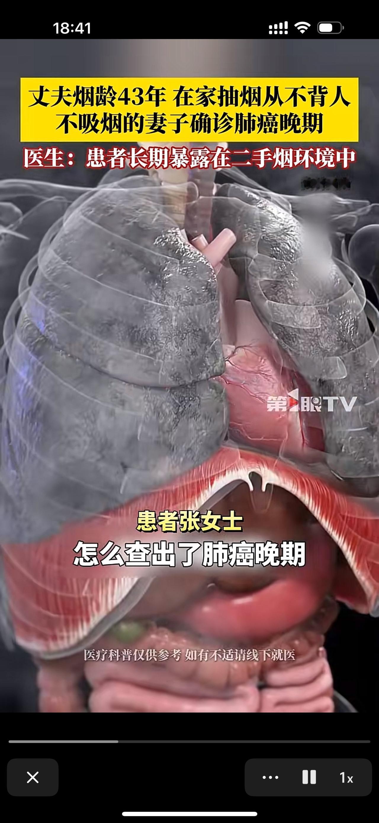 不抽烟却查出肺癌晚期？吸烟不仅是对自己的不负责，更是对家人的不负责！丈夫吸烟4