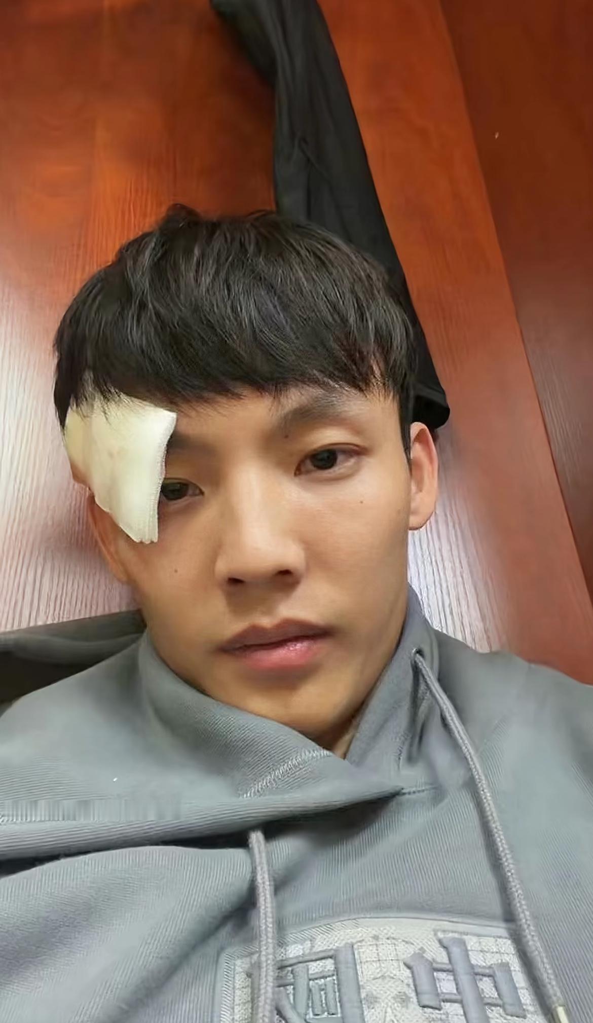 杜峰说过，受伤是男人的勋章🎖️，昨晚徐杰在脸上又添了一枚勋章，国难思良将，徐杰