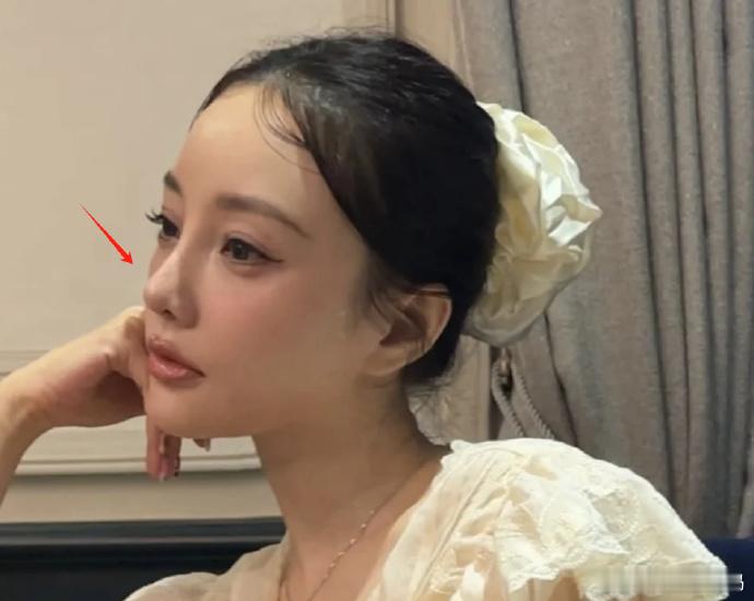 李小璐近照鼻头发黑泛红，43岁了还在追求少女感，彻底变成幼态脸​​​