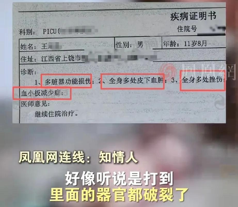 太痛心了!11岁零8个月的孩子,被五六个同学围着打了整整6小时,打到内脏破裂进I