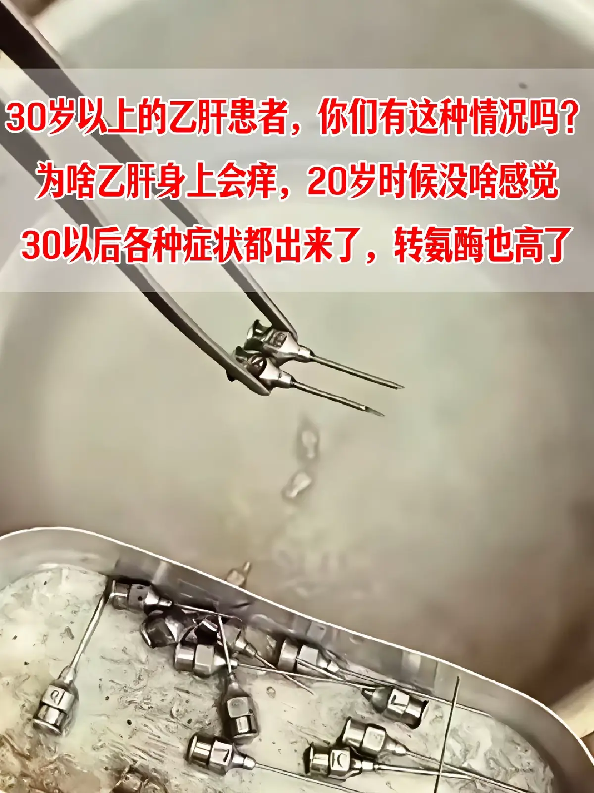 “阚教授，我感染乙肝 20 年，早年一点症状都没有，刚过 30 岁，胸...