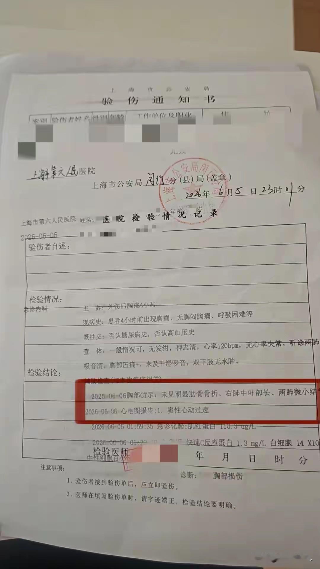 上海，男子带着怀孕38周的妻子到一家餐馆吃饭，发现邻座醉酒男子准备吸烟，于是，上