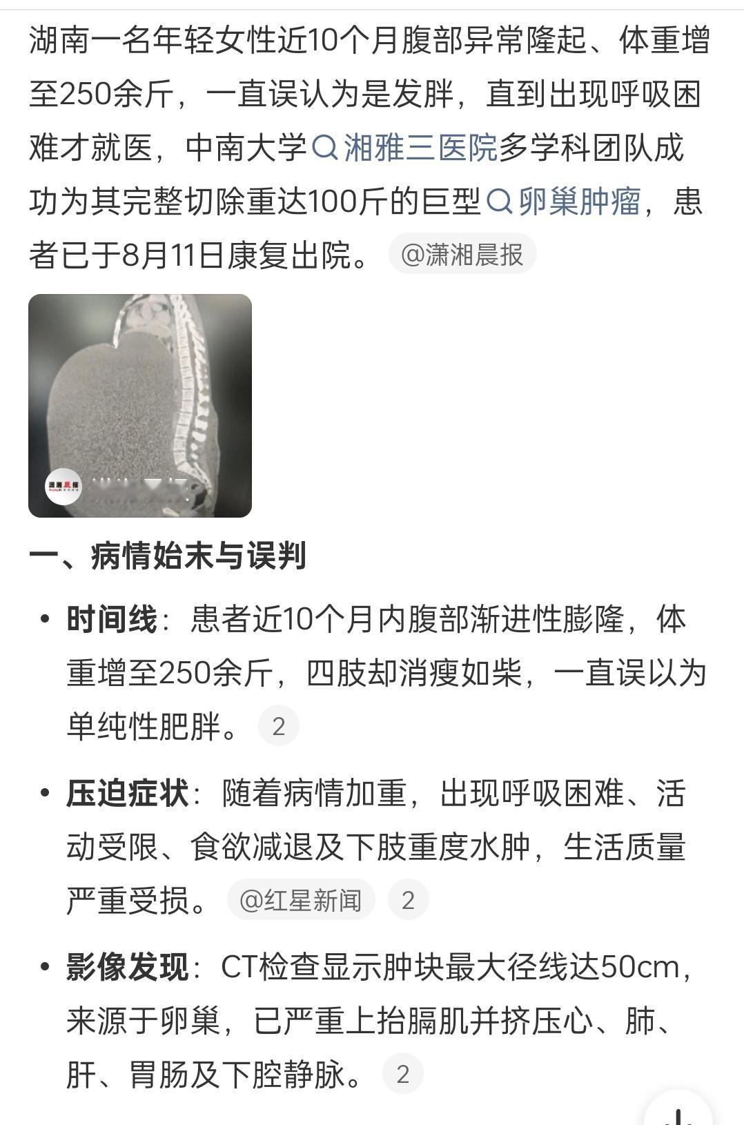 医生回应女子卵巢长100斤肿瘤[惊恐][惊恐][惊恐]​​​