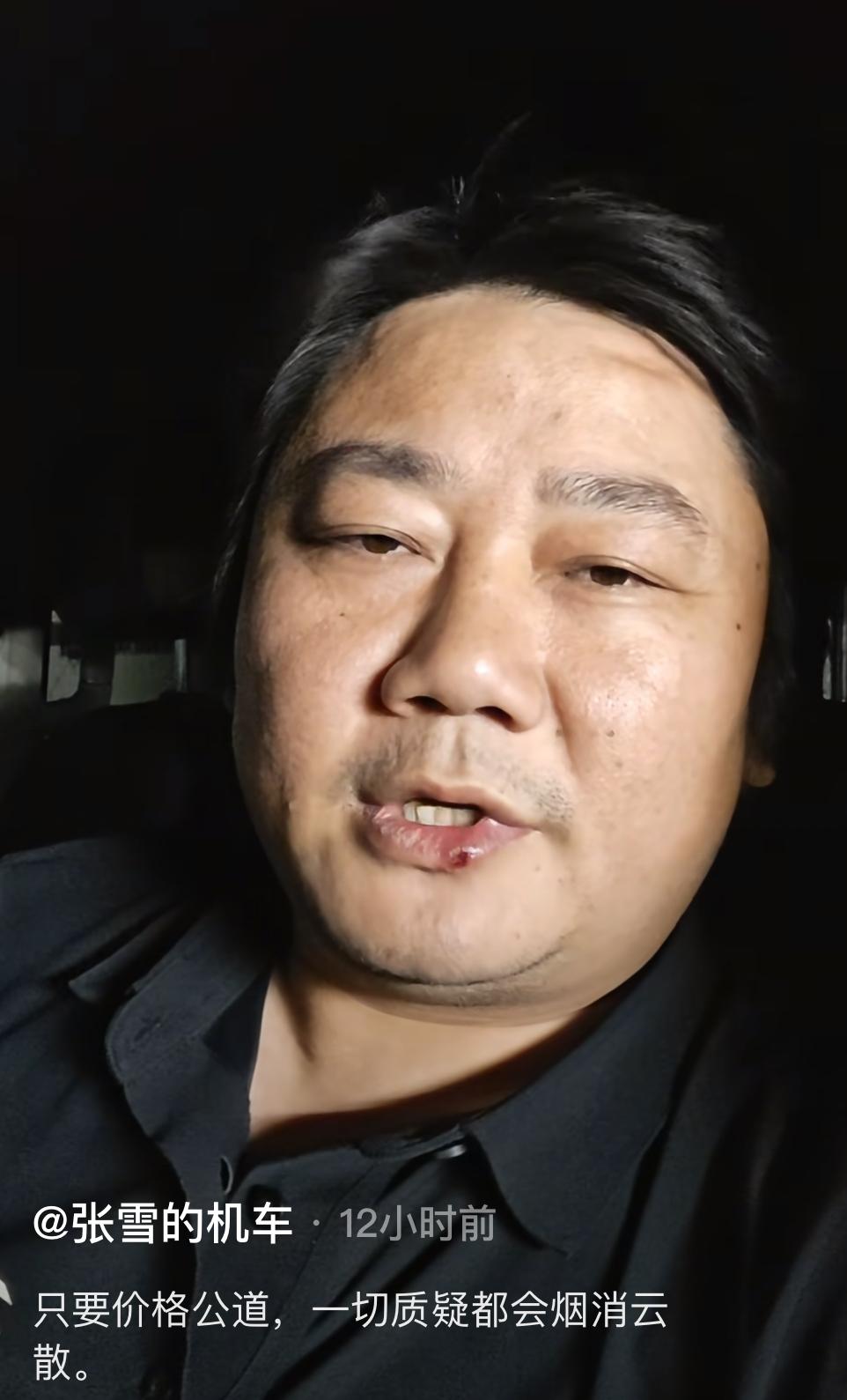 张雪这次说得很直接。面对韩红基金会救护车采购引发的争议，他在凌晨发布视频表示：“