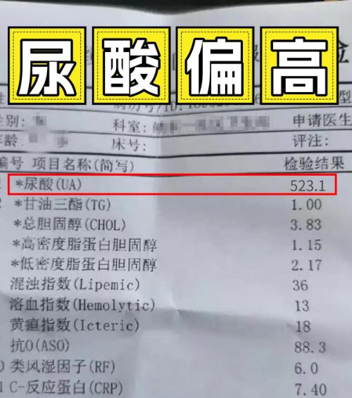 体检尿酸偏高但没痛过？医生：这3个习惯不改，迟早痛风很多人体检查出尿酸偏高，因