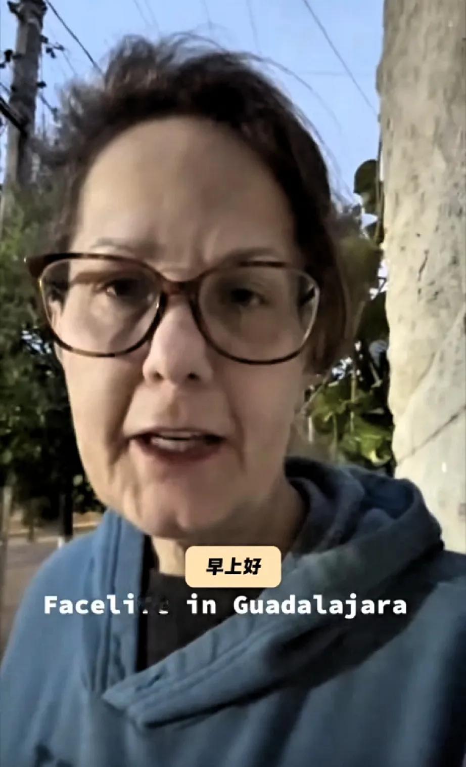 国外有位女士在墨西哥做了拉皮手术！面容从51岁直接秒变25岁！且术后恢复良好！整