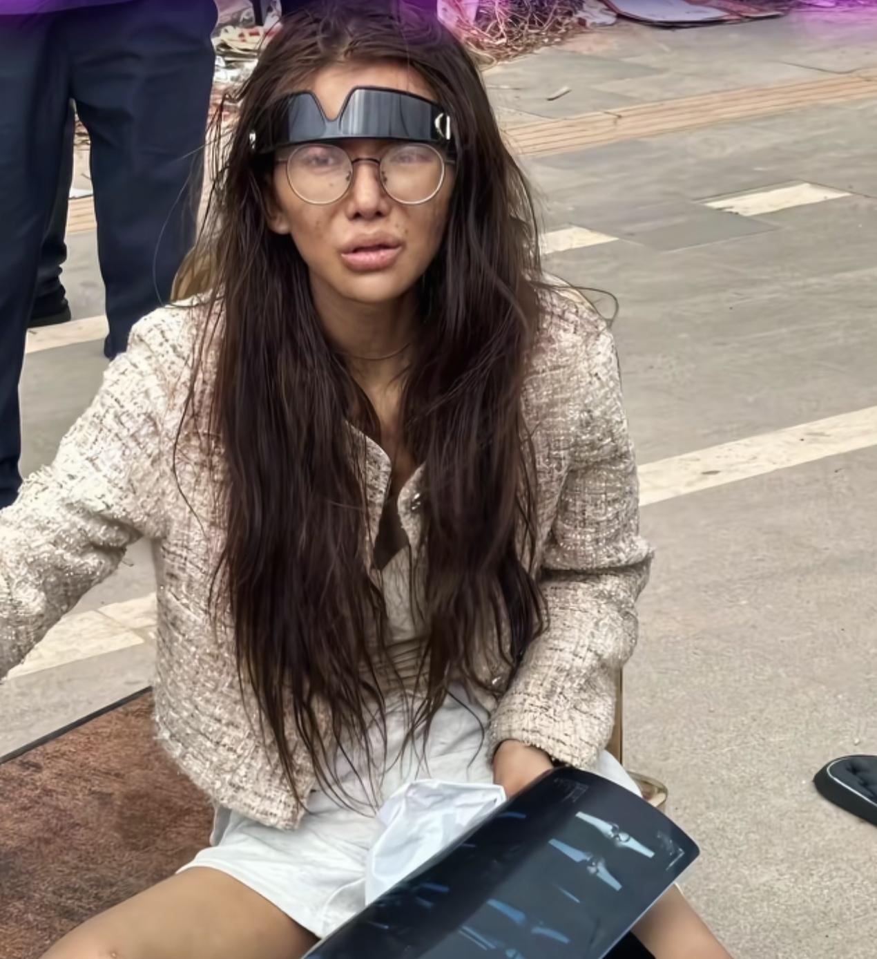 流浪柬埔寨网红可算回国了，在国内光鲜亮丽，但被骗到国外赚大钱，差点回不来，从医院