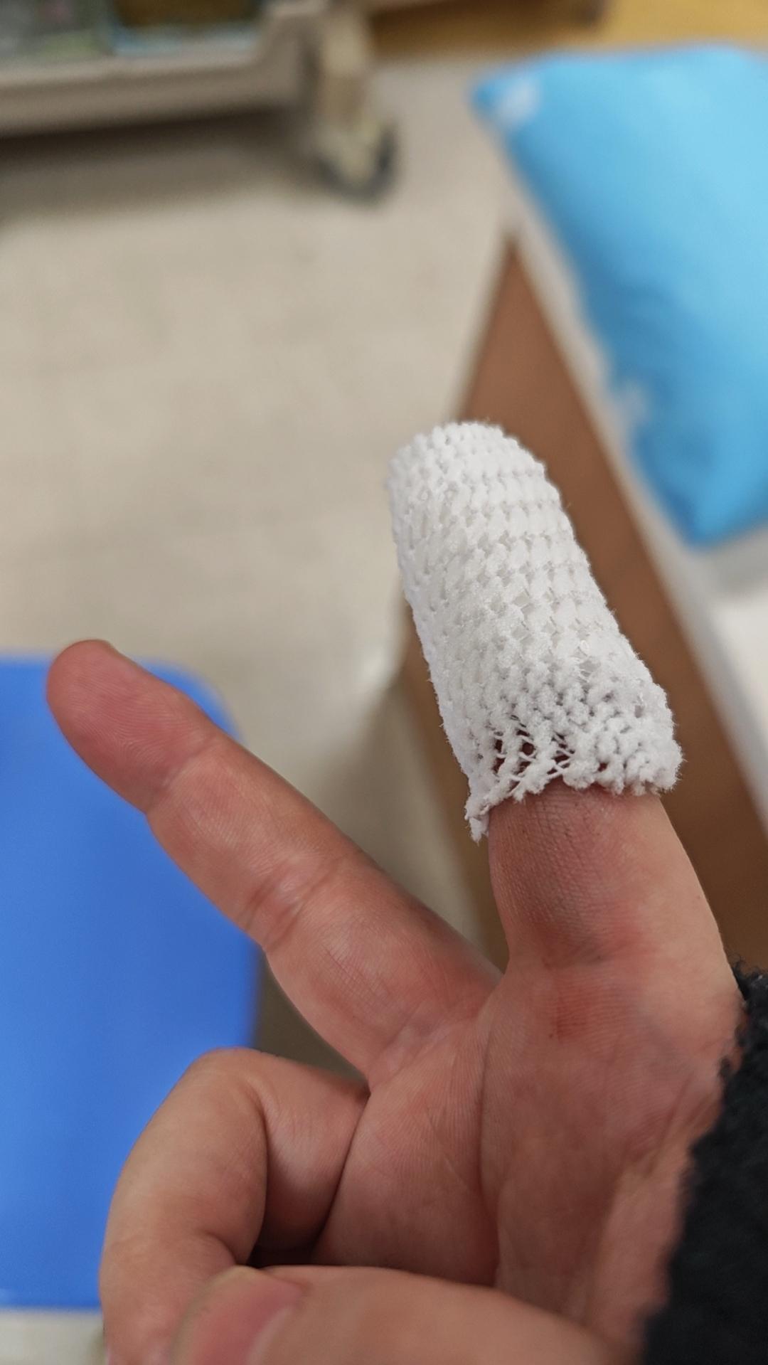 血的教训！昨天帮朋友解袋子，手刚伸过去，她急着“咔嚓”一剪刀——直接剪到我手上，