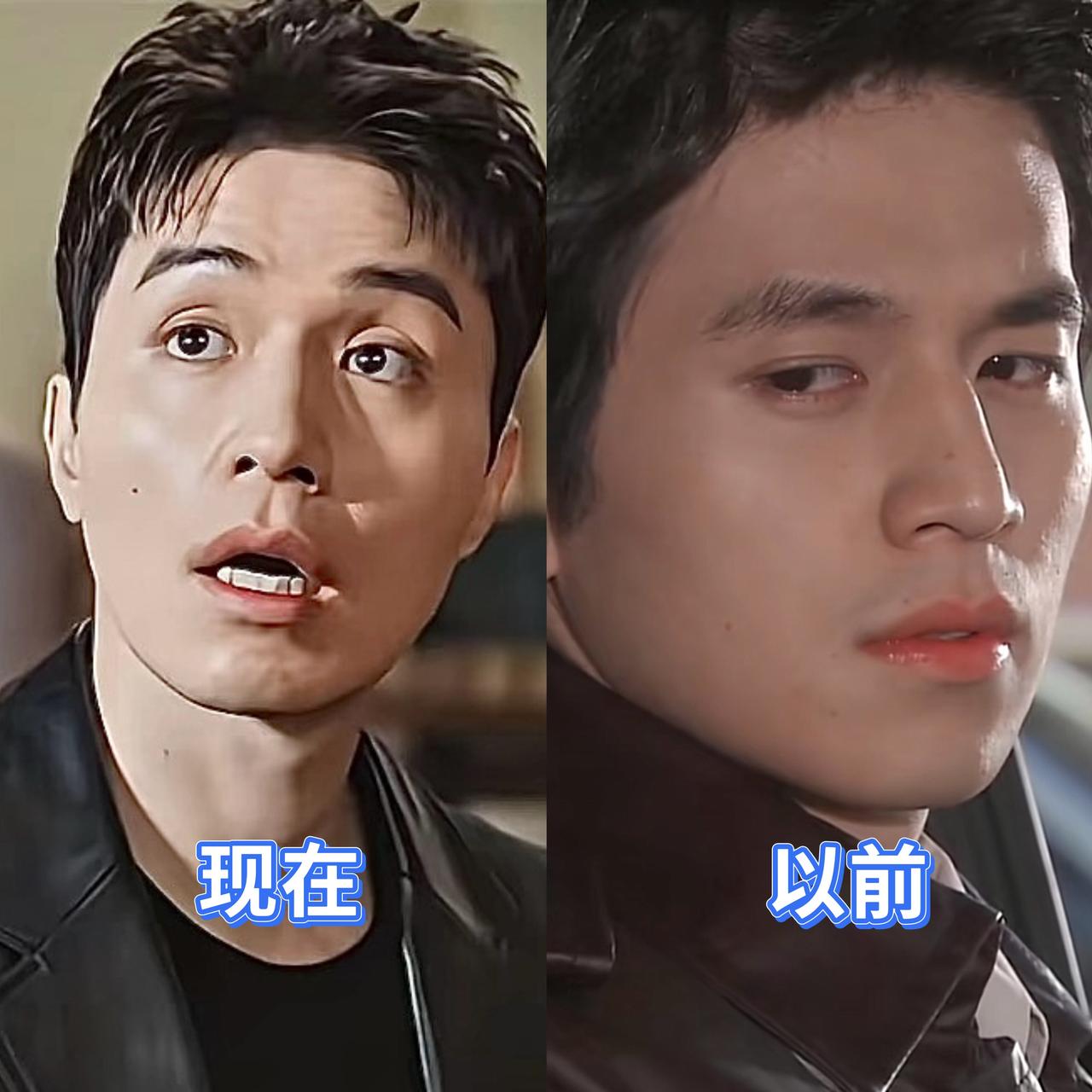 李栋旭现在照镜子的时候会想哭吧原本被人称之为韩国初代男神的一张脸，现在
