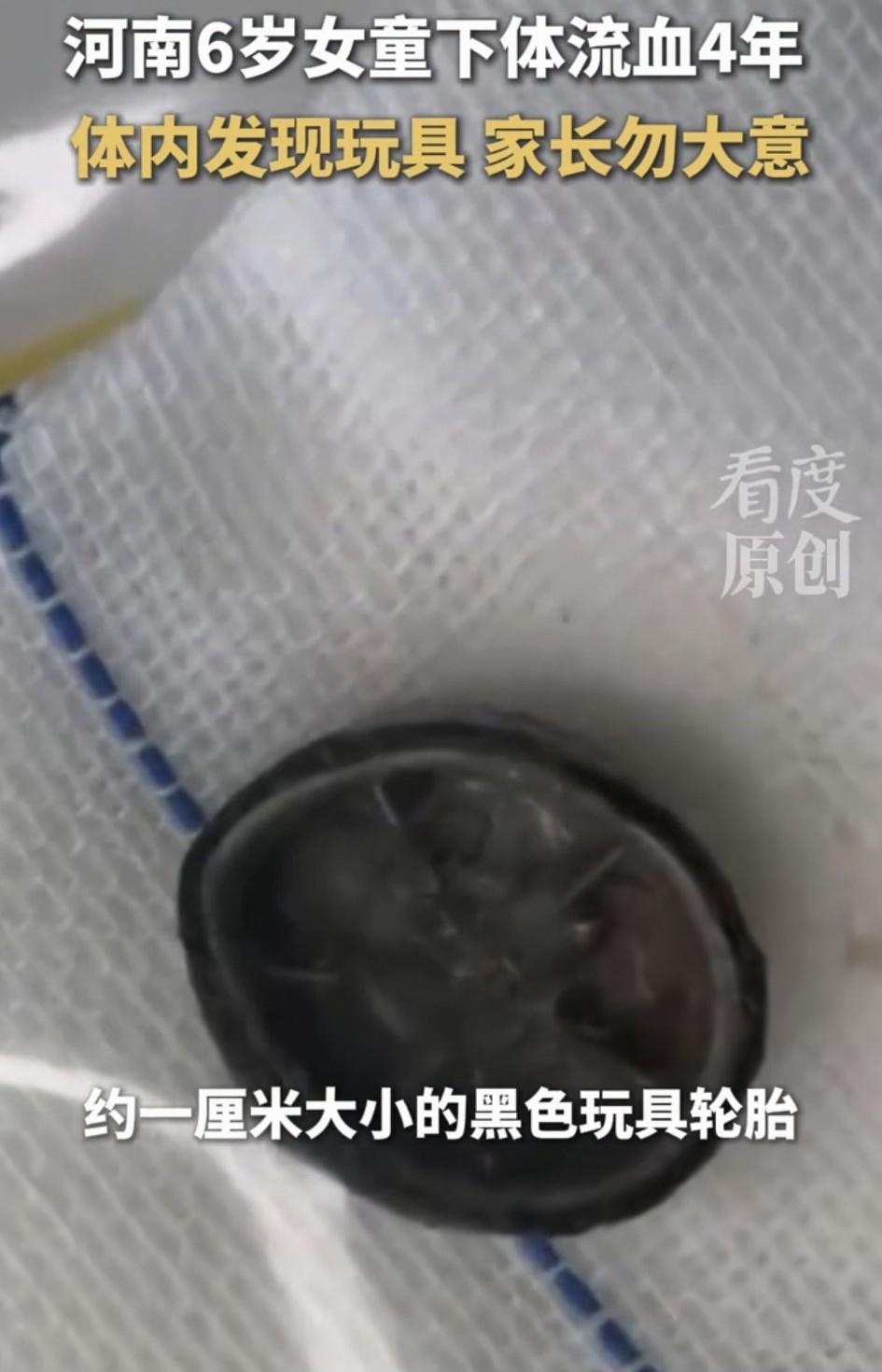 太不上心了吧！河南一名6岁女孩，反复下体出血长达4年，期间家长也将其送当地几家医