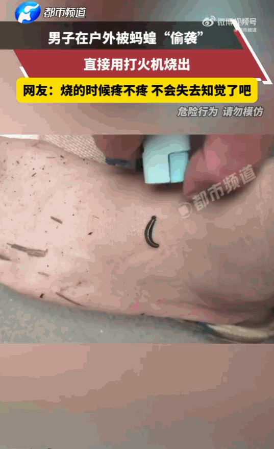 真是狠的遇到了更狠的！河南，一名男子在户外活动时，意外遭到了蚂蟥的“偷袭”，这个