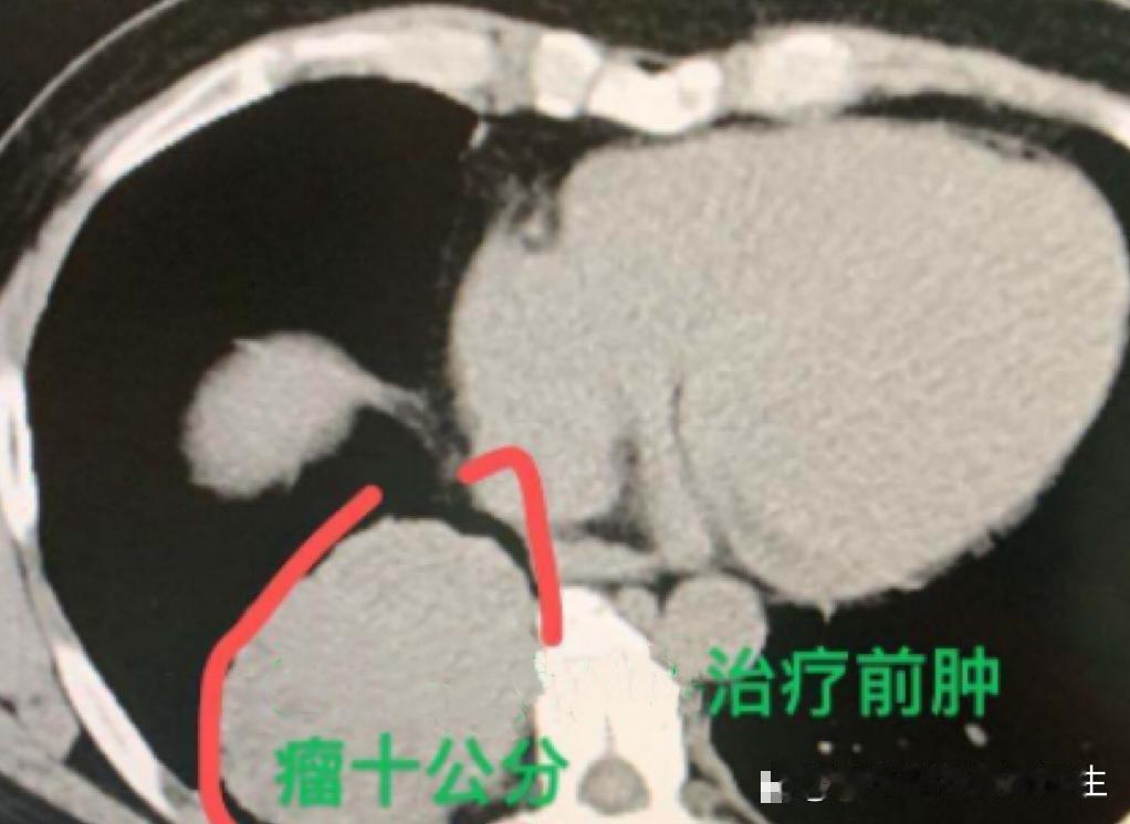 “乔主任，我真的撑不下去了，这个病治不好的，我也不想活了。”说出这句话的患者才3