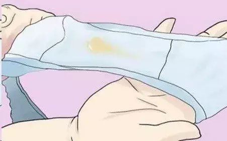 经期结束了, 还有褐色分泌物流出, 是怎么回事?