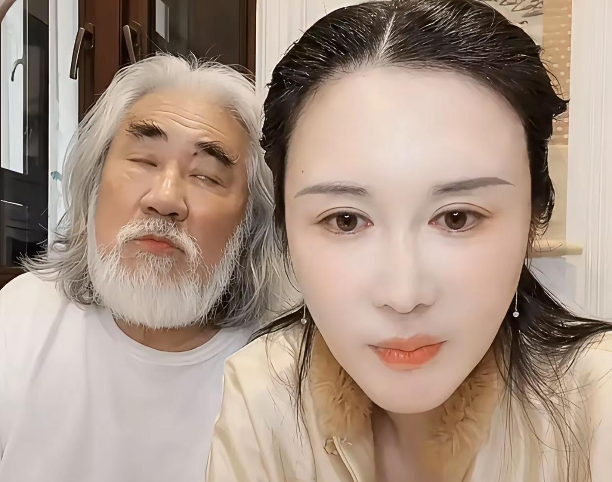 你刷到张纪中杜星霖的直播时，有没有皱过眉？71岁的他脸色蜡黄、频频扶腰，却还在镜