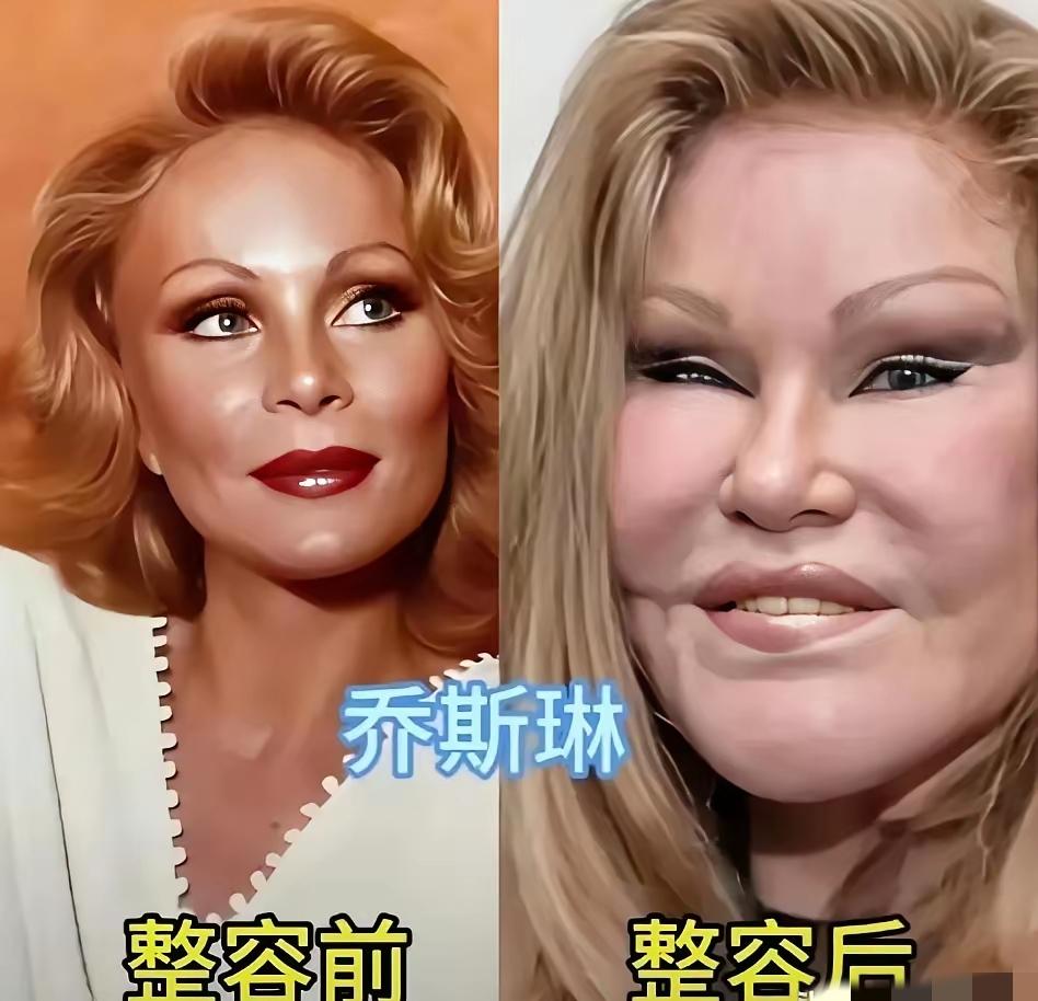优雅自然老去难道不好吗？有些女星过度整容，到最后脸变得千篇一律，看着有点违和。