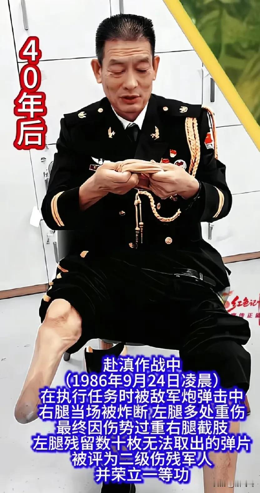 一等功臣郭玉林1986年9月24日凌晨，在执行任务时被敌军炮弹击中，右腿当场被