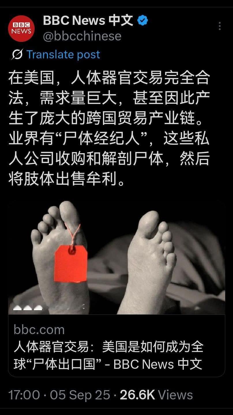 BBC报道:在美国人体交易完全合法，甚至产生了国际贸易链，美国因此成为全球
