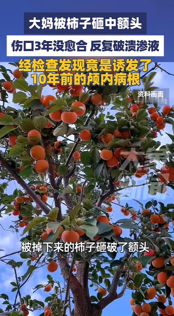 “万万没想到！”6月5日报道，江苏南京，一大妈被掉下来的柿子砸破头，她看这上过剖