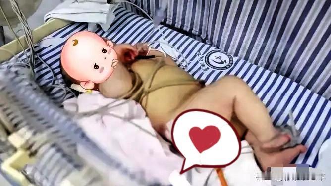 29岁产妇顺产下足月男婴，全家还没来得及高兴，接产医生一翻裤裆当场愣住：孩子屁股
