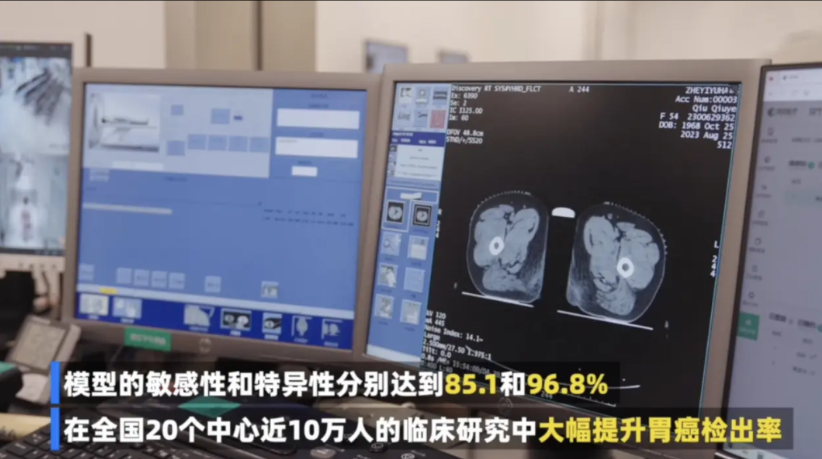 全球首例，复旦科学家让失明动物成功恢复视觉能力。6月6日，复旦科学家在《科学》杂