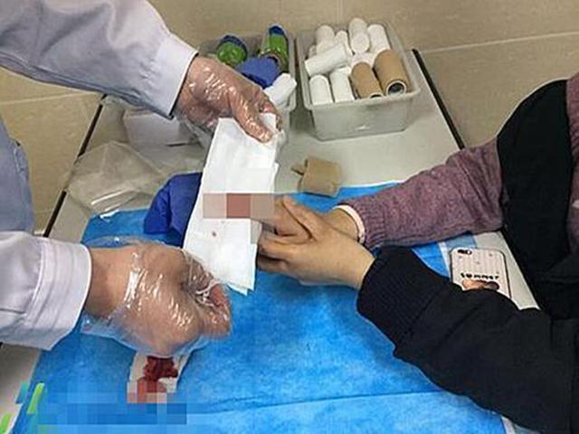 8个月的孕妇宁愿截断一根手指, 也要保住肚子里的孩子