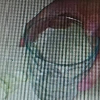 牙疼不是病，疼起来真要命！我以前牙疼时，试过不少快速止疼法。含花椒是个老办法，我