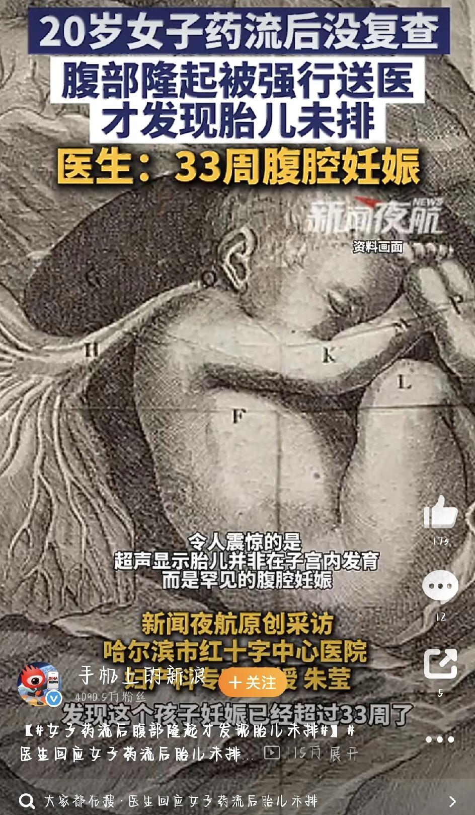 20岁的小姑娘小暖（化名）独自在外地生活，意外怀孕后心里又慌又怕，没敢上医院，自