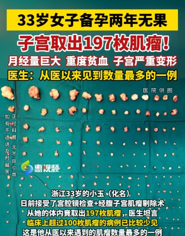 太吓人了！浙江，一33岁女子备孕两年肚子迟迟没动静，月经量大到血色素跌至63g/