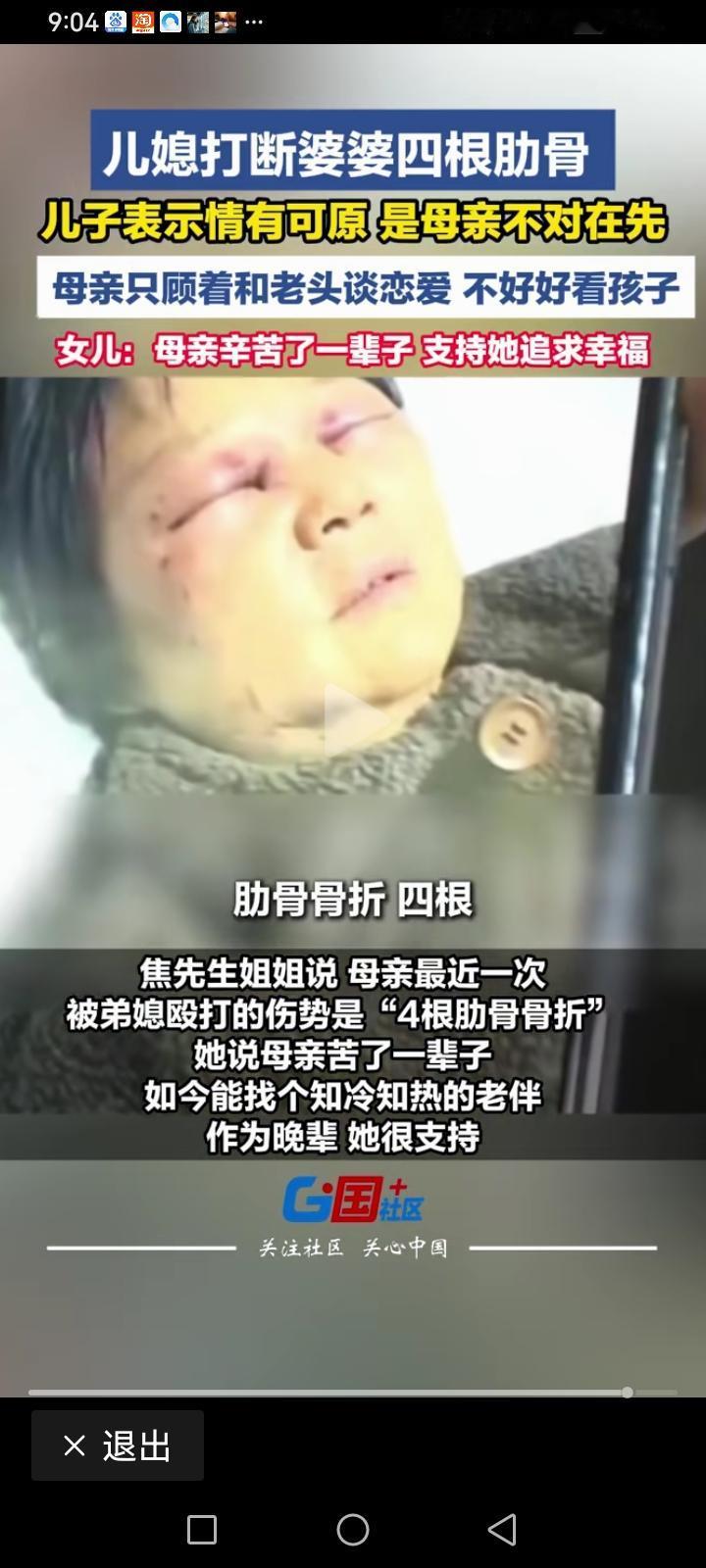 浙江嘉兴一儿媳妇把婆婆打的鼻青脸肿的，还打折了四根肋骨，记者采访儿子，儿子说是母
