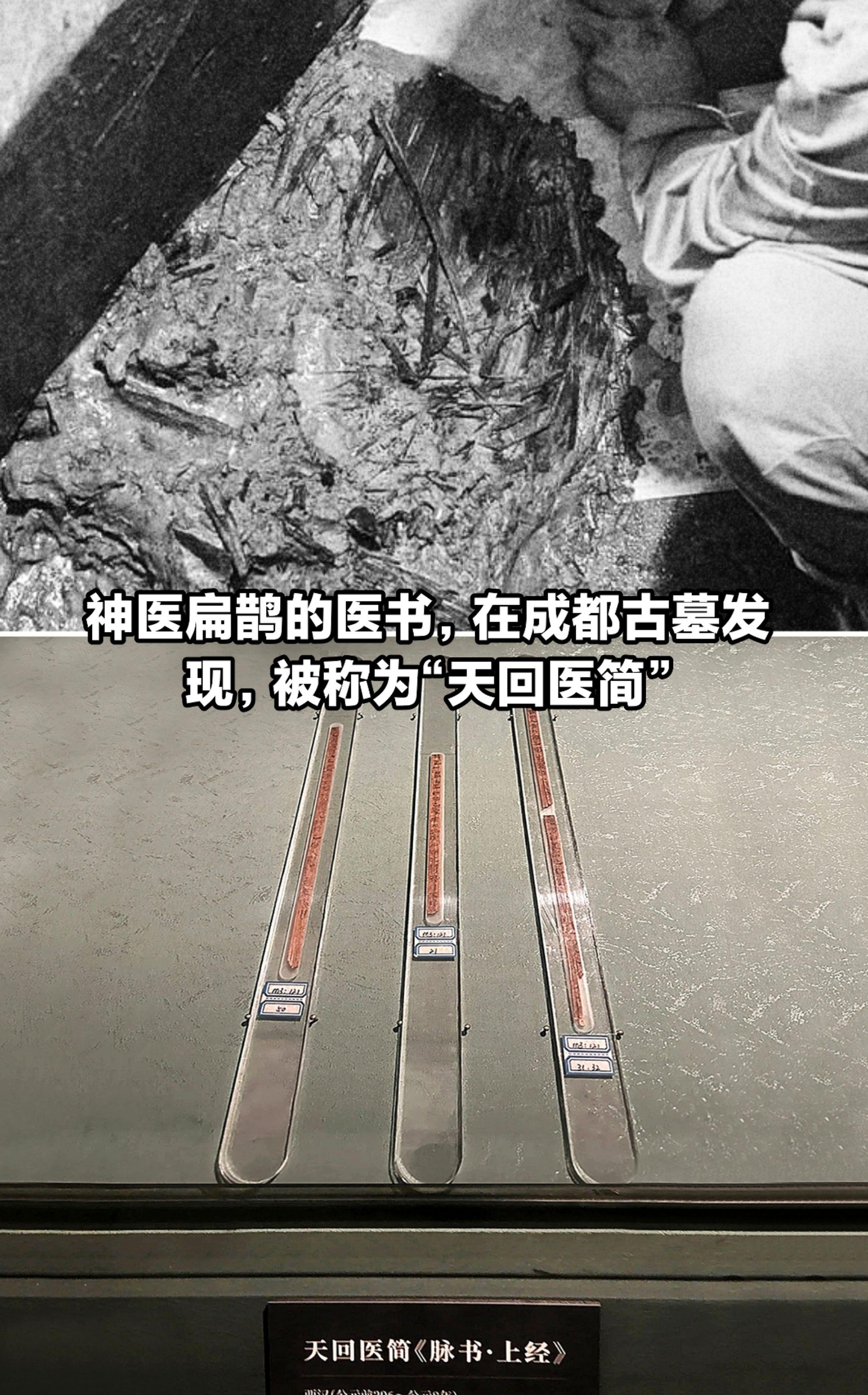 神医扁鹊的医术，在成都古墓被发现。