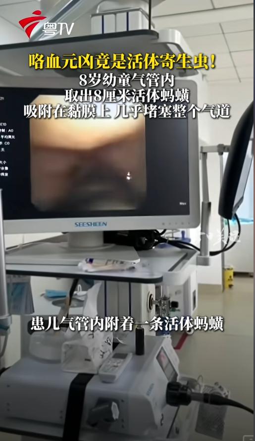 “咋就不长点记性呢？”4月21日，云南临沧，一小男孩因咳血到医院就诊。检查发现，