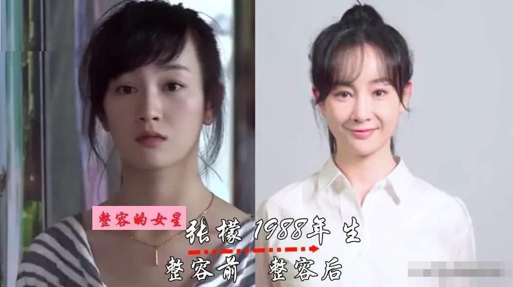 整容失败的张檬整容失败的孙菲菲整容失败的张萌这三位演技派的女演员，没整容之