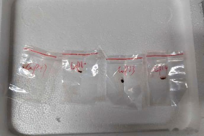 【美国逮捕另一名无证运送生物材料的中国科学家】（美联社）——美国当局周一表示，一