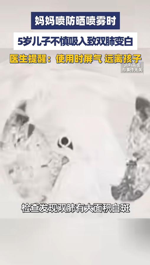 “千万不能吸进去！”6月7日人民日报报道，河南郑州，一位5岁的小男孩突然间咳嗽胸