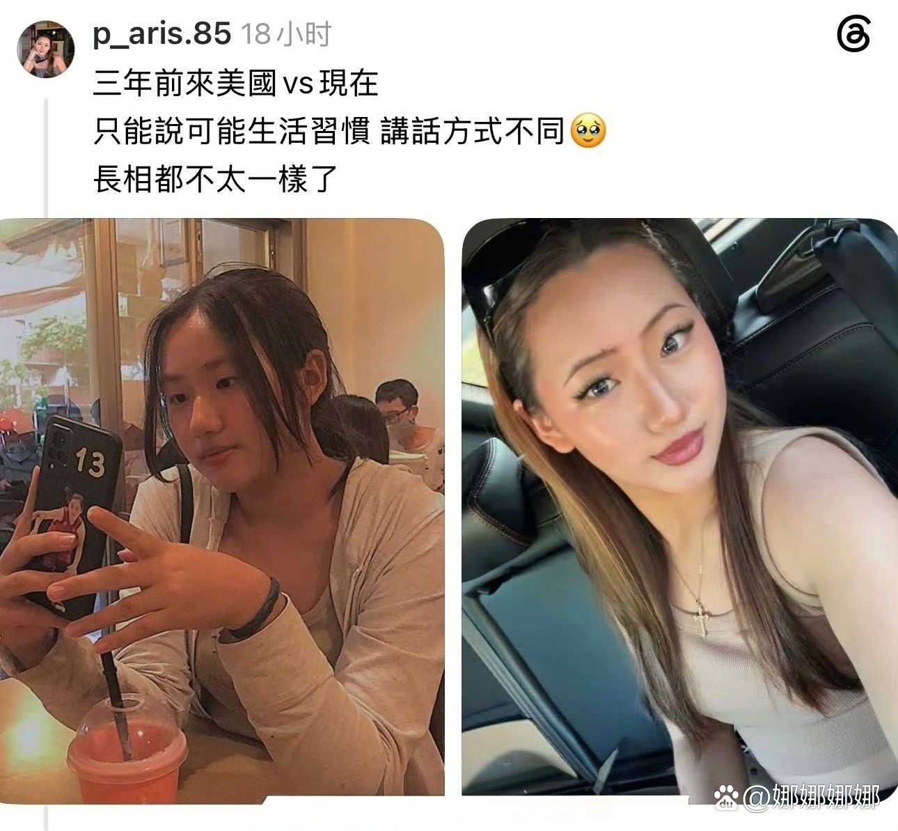 去漂亮国三年变化好大…
