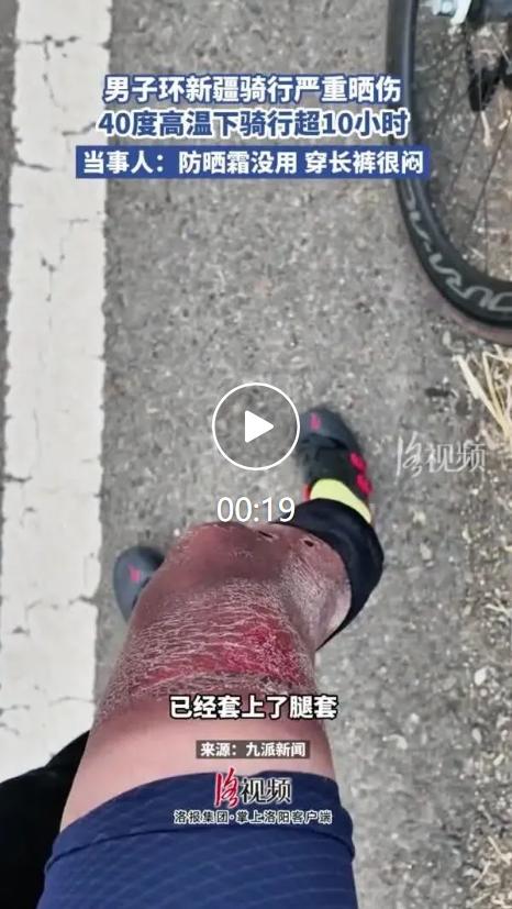 很多骑行爱好者向往环新疆长途骑行，沿途戈壁、公路风景壮阔，但当地紫外线强度远超内