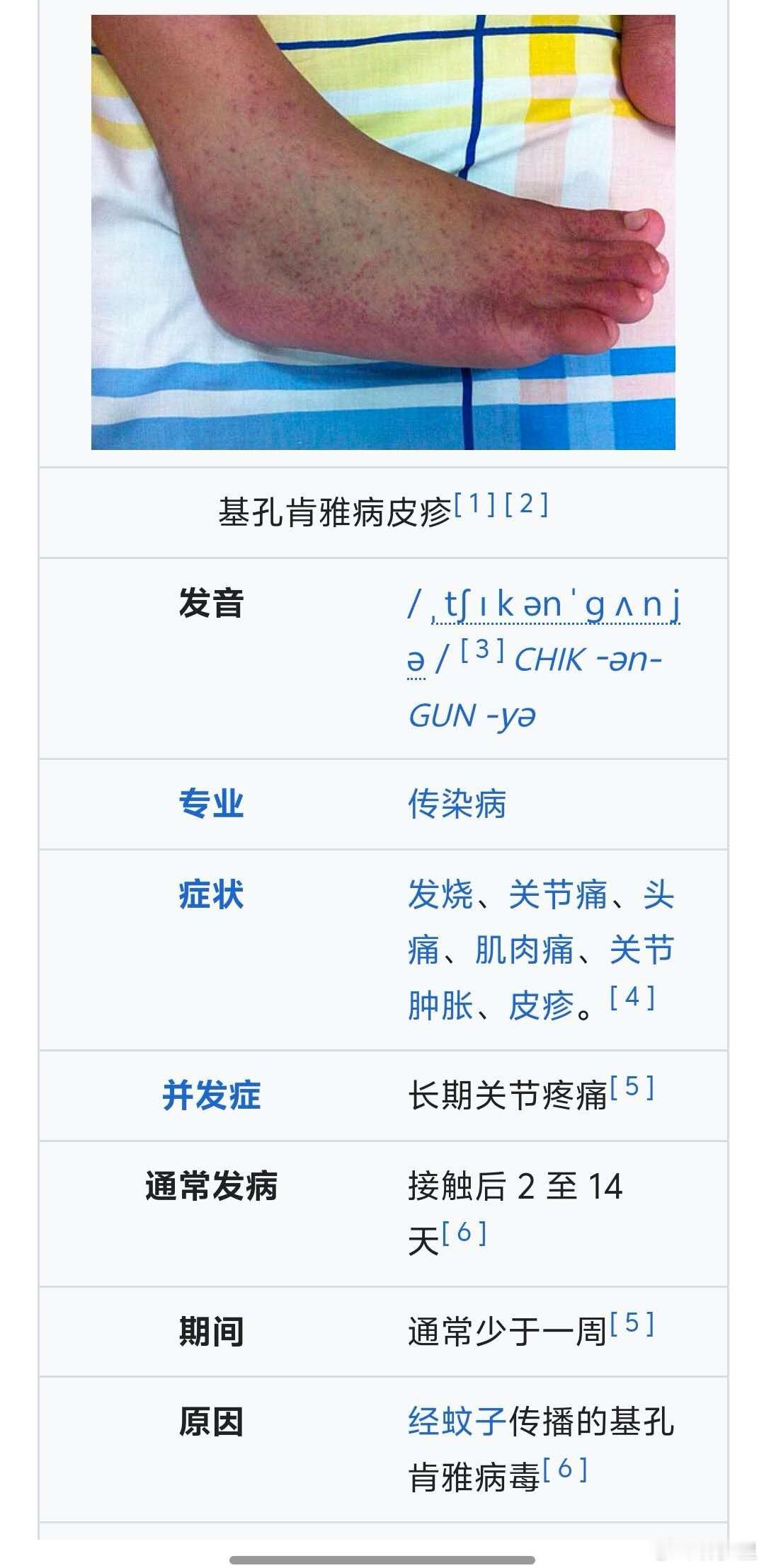 佛山顺德区确诊478例基孔肯雅热这又是一种通过蚊子传播的病毒，叫基孔肯雅病毒。基
