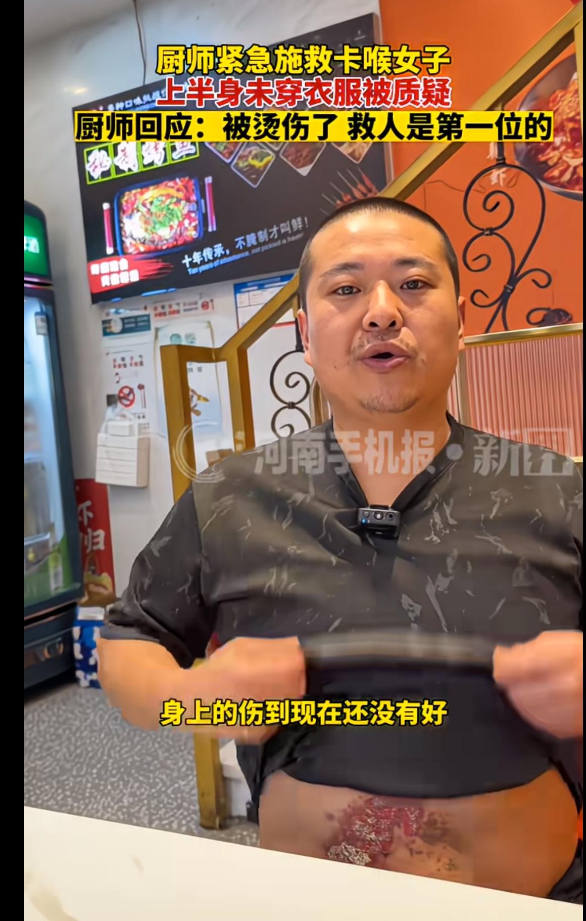 赤裸上身救吃鱼被卡女顾客的后厨大哥回应了，自己当时光着上身是因为自己身上有烫伤不