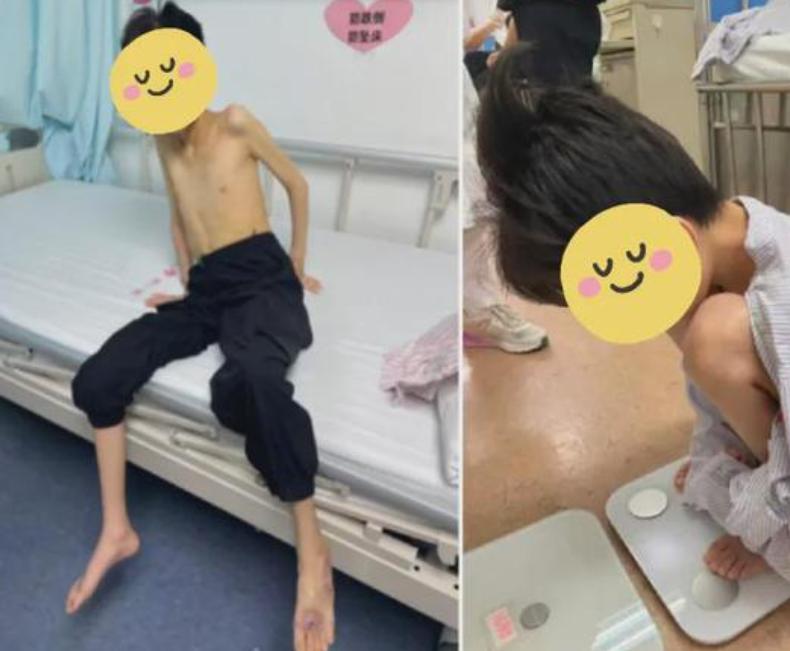 悲剧还是发生了！江西，一17岁少年，六年来反复呕吐、无法进食，身高150厘米的他