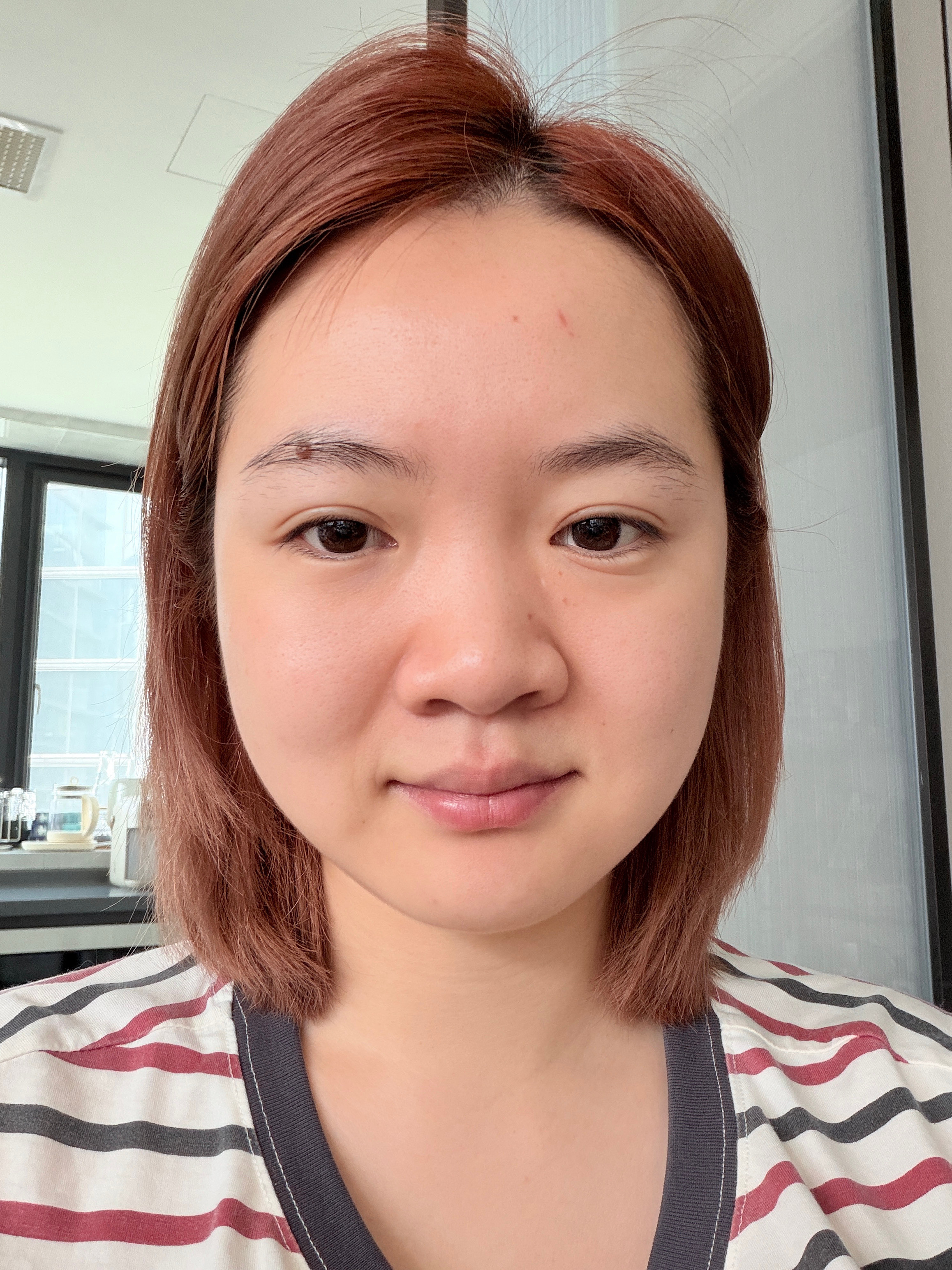 昨晚是我贪了，但也没必要肿成这样吧昨晚没吃够，今天又让阿姨做了辣椒炒肉还有可乐鸡