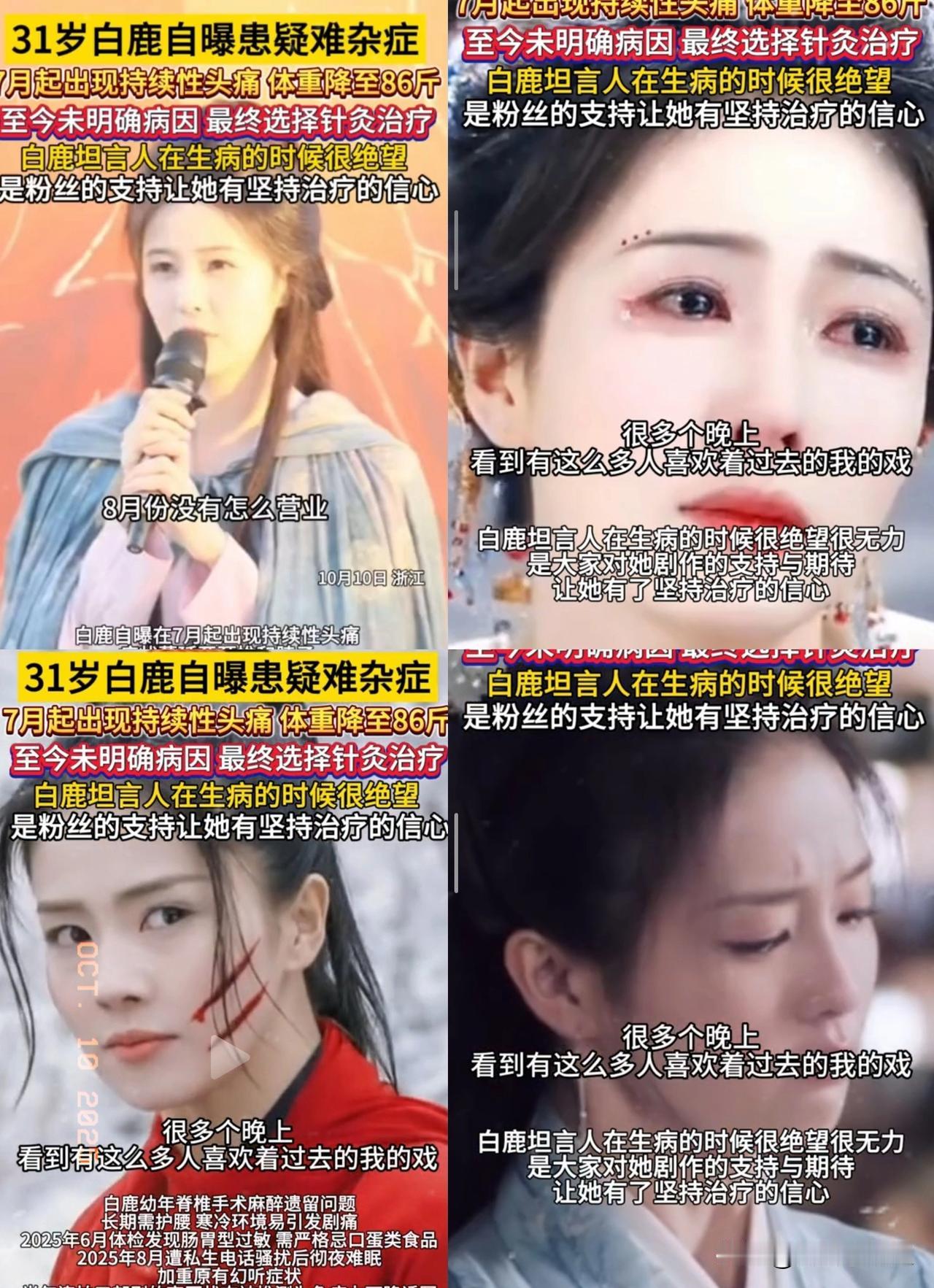 31岁的白鹿近日自曝患上疑难杂症，从7月开始出现持续性头痛，症状还蔓延到颈椎