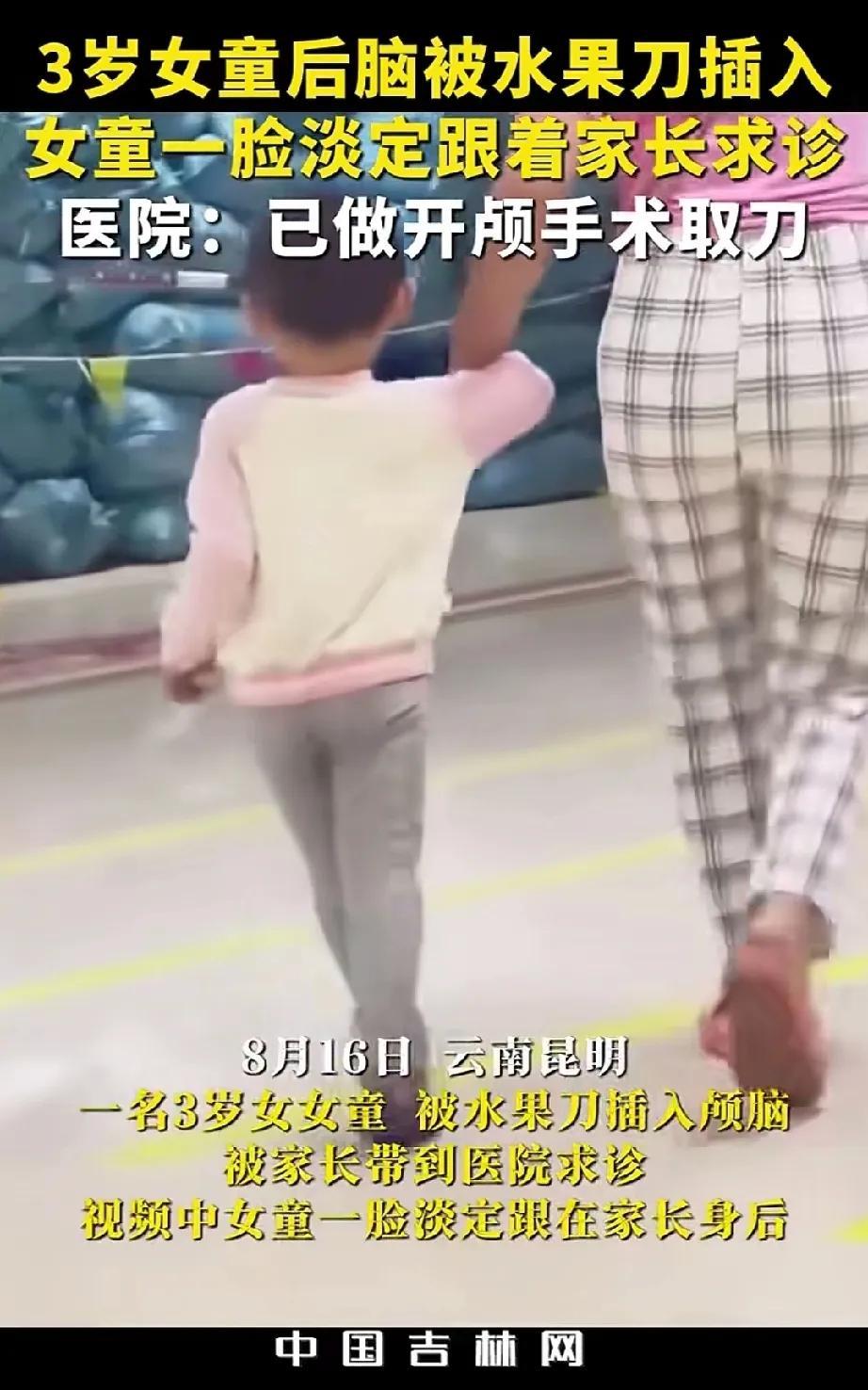 太吓人了，三岁女童头上插刀，随妈妈步行淡定进入医院手术。8月15日，在云南昆明