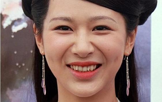 不比不知道，一比便知差距显著，这下可算明白为何众多明星都争着去做医美了。整容前